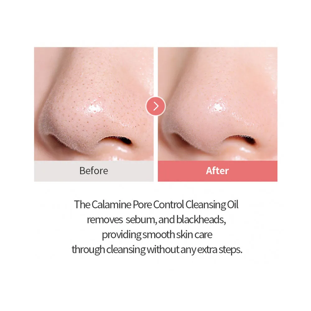 Calamine Pore Control Cleansing Oil (Mini)